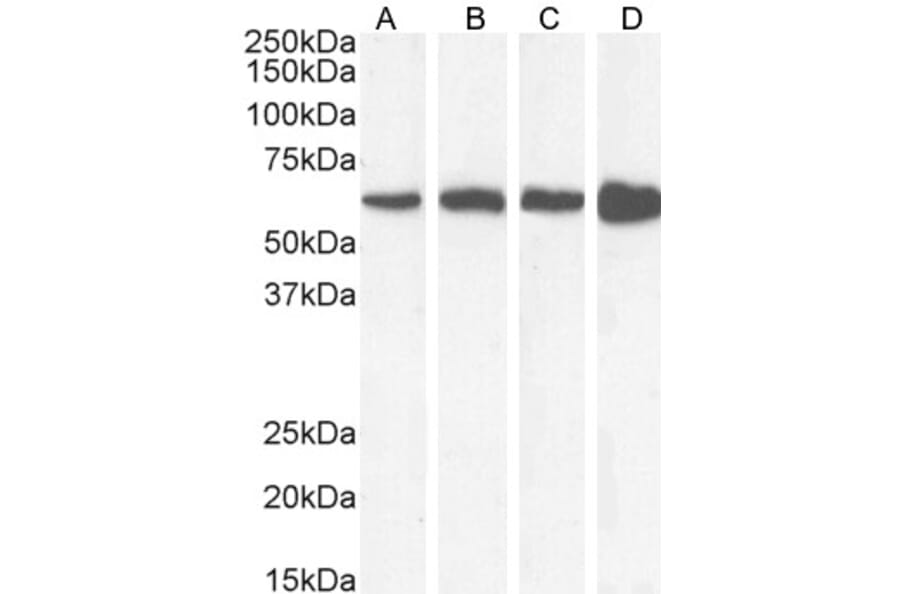 Western Blot - Anti-Catalase Antibody (A84220) - Antibodies.com