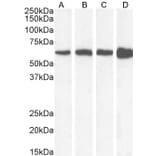 Western Blot - Anti-Catalase Antibody (A84220) - Antibodies.com