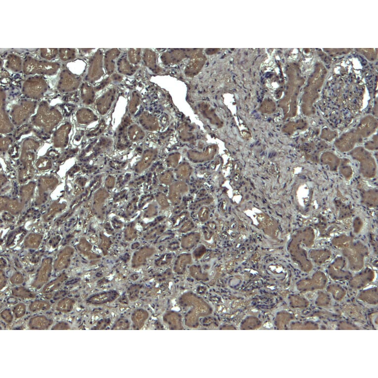 Immunohistochemistry - Anti-Catalase Antibody (A84220) - Antibodies.com