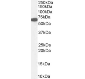 Western Blot - Anti-CAT Antibody (A84220) - Antibodies.com