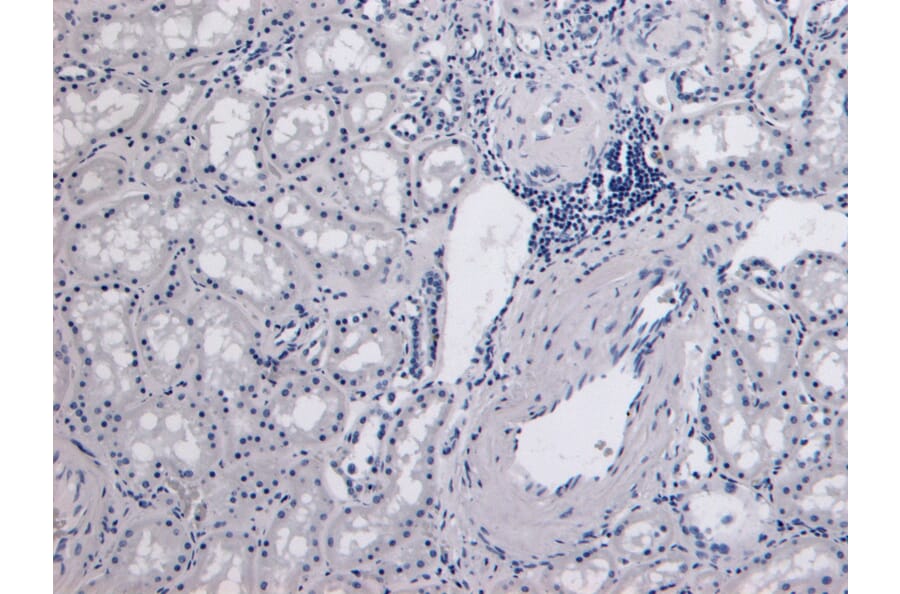 Immunohistochemistry - Anti-Catalase Antibody (A84220) - Antibodies.com
