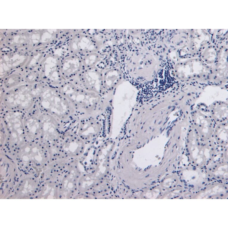 Immunohistochemistry - Anti-Catalase Antibody (A84220) - Antibodies.com