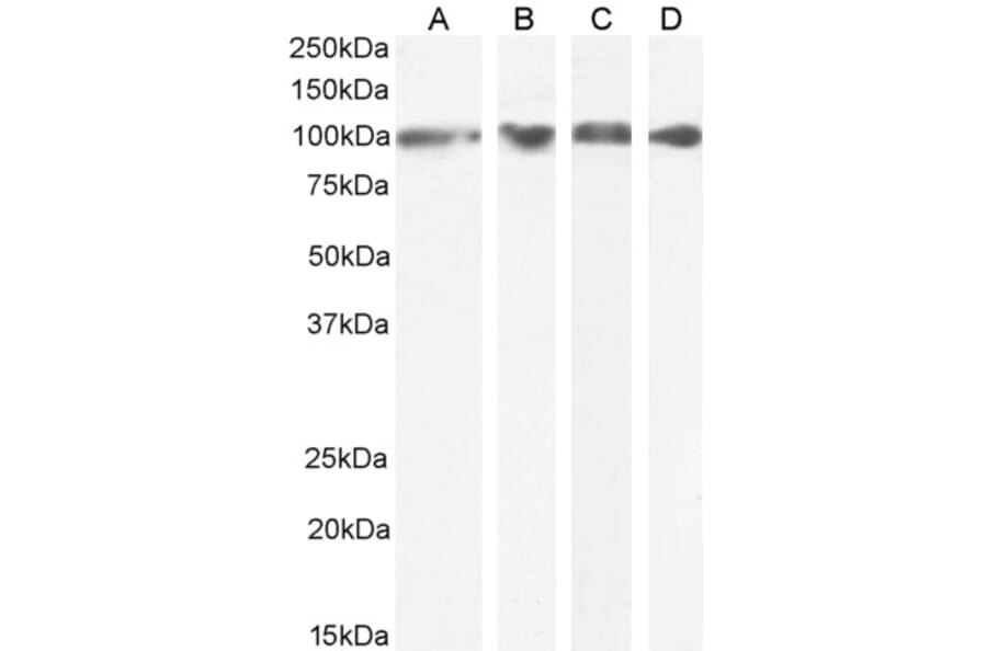 Western Blot - Anti-GRP94 Antibody (A84222) - Antibodies.com