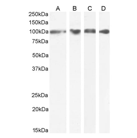 Western Blot - Anti-GRP94 Antibody (A84222) - Antibodies.com