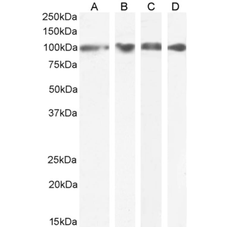 Western Blot - Anti-GRP94 Antibody (A84222) - Antibodies.com