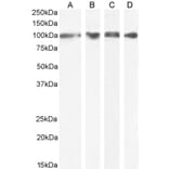 Western Blot - Anti-GRP94 Antibody (A84222) - Antibodies.com