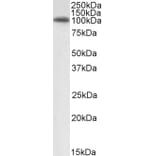 Western Blot - Anti-GRP94 Antibody (A84222) - Antibodies.com