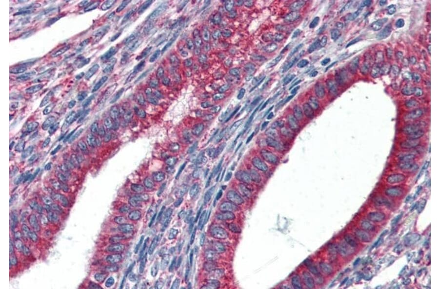 Immunohistochemistry - Anti-GRP94 Antibody (A84222) - Antibodies.com