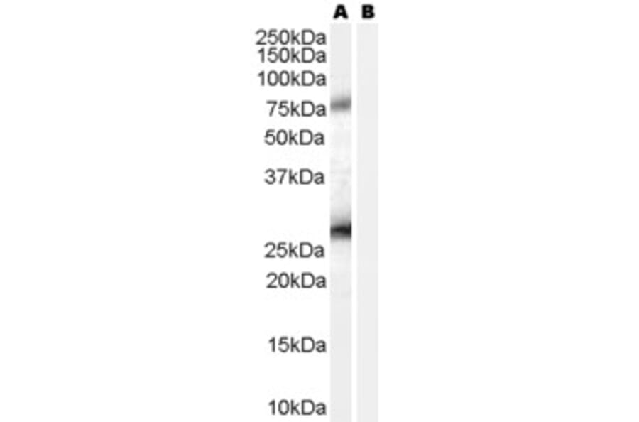 Western Blot - Anti-RCAS1 Antibody (A84223) - Antibodies.com