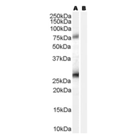 Western Blot - Anti-RCAS1 Antibody (A84223) - Antibodies.com