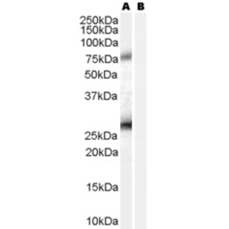 Western Blot - Anti-RCAS1 Antibody (A84223) - Antibodies.com