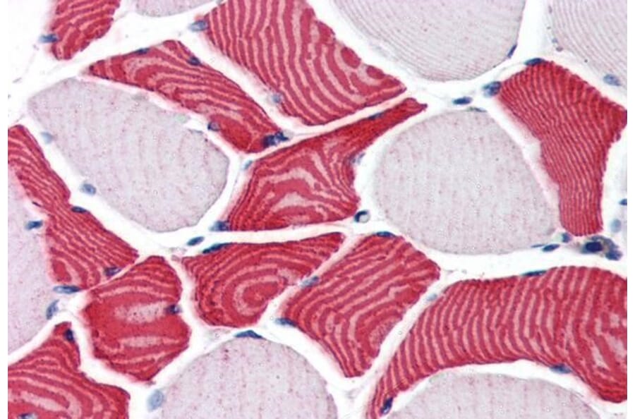 Immunohistochemistry - Anti-RCAS1 Antibody (A84223) - Antibodies.com