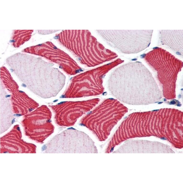 Immunohistochemistry - Anti-RCAS1 Antibody (A84223) - Antibodies.com