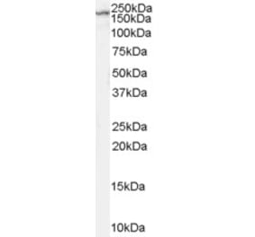 Western Blot - Anti-NMDAR2B Antibody (A84224) - Antibodies.com