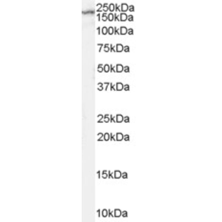 Western Blot - Anti-NMDAR2B Antibody (A84224) - Antibodies.com
