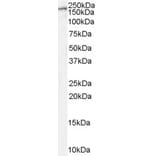 Western Blot - Anti-NMDAR2B Antibody (A84224) - Antibodies.com