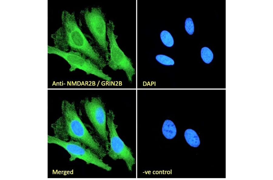 Immunofluorescence - Anti-NMDAR2B Antibody (A84224) - Antibodies.com