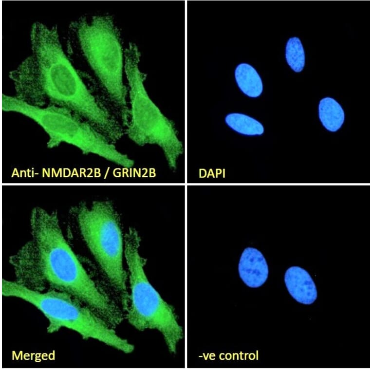 Immunofluorescence - Anti-NMDAR2B Antibody (A84224) - Antibodies.com