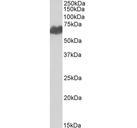 Western Blot - Anti-Melanoma gp100 Antibody (A84225) - Antibodies.com