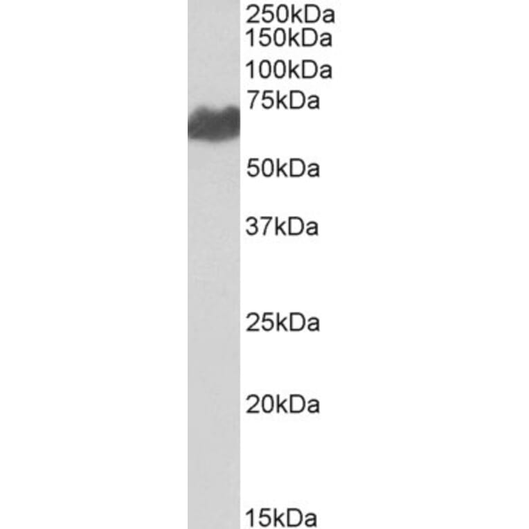 Western Blot - Anti-Melanoma gp100 Antibody (A84225) - Antibodies.com