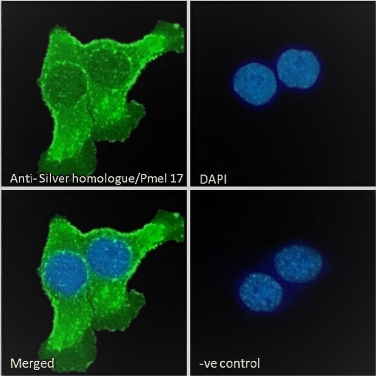 Immunofluorescence - Anti-Melanoma gp100 Antibody (A84225) - Antibodies.com