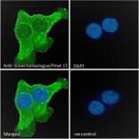 Immunofluorescence - Anti-Melanoma gp100 Antibody (A84225) - Antibodies.com