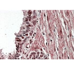 Immunohistochemistry - Anti-ZNF217 Antibody (A84227) - Antibodies.com