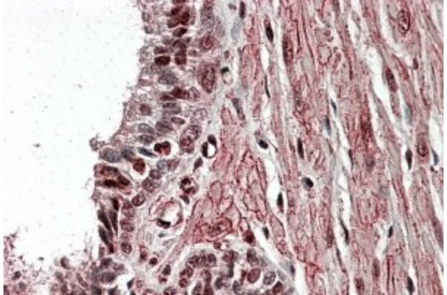 Immunohistochemistry - Anti-ZNF217 Antibody (A84227) - Antibodies.com