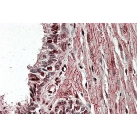 Immunohistochemistry - Anti-ZNF217 Antibody (A84227) - Antibodies.com