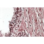 Immunohistochemistry - Anti-ZNF217 Antibody (A84227) - Antibodies.com