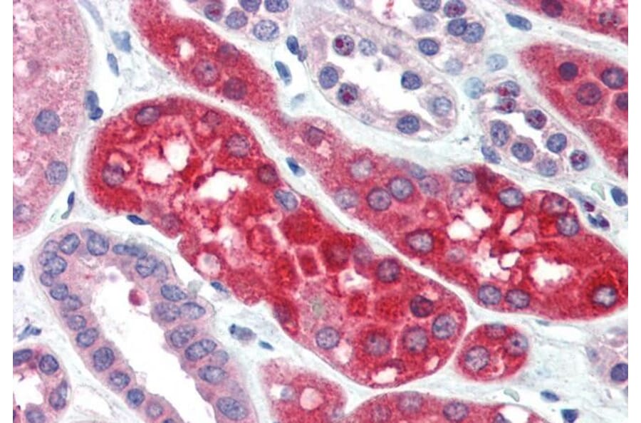 Immunohistochemistry - Anti-Ezrin Antibody (A84228) - Antibodies.com