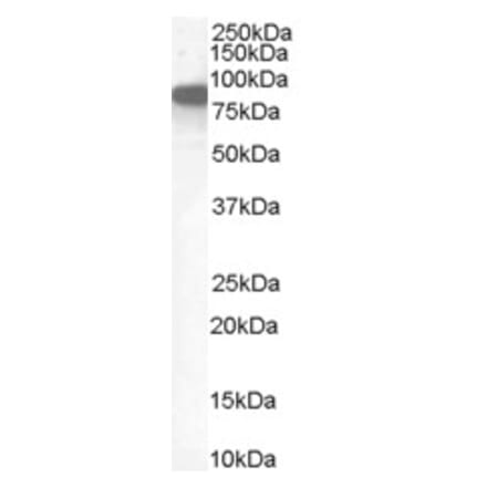 Western Blot - Anti-EZRIN Antibody (A84228)