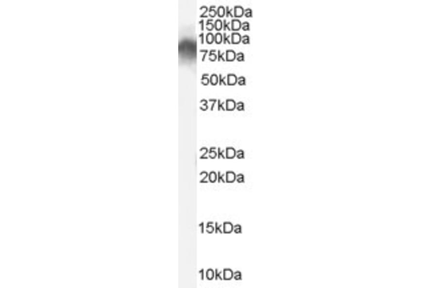Western Blot - Anti-Radixin/RDX Antibody (A84229) - Antibodies.com