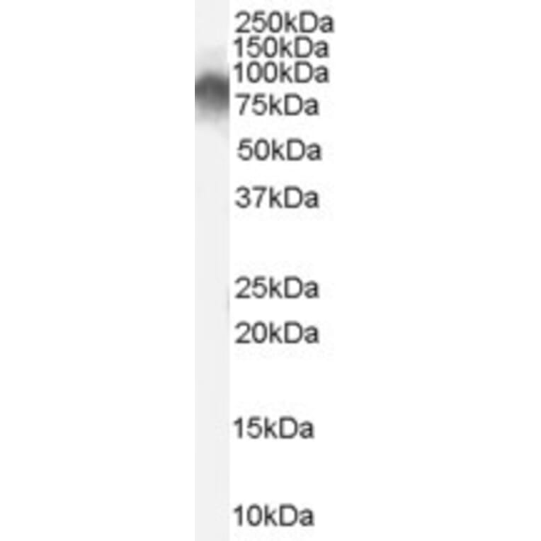 Western Blot - Anti-Radixin/RDX Antibody (A84229) - Antibodies.com