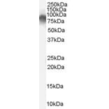 Western Blot - Anti-Radixin/RDX Antibody (A84229) - Antibodies.com