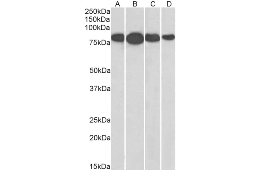 Western Blot - Anti-Radixin/RDX Antibody (A84229) - Antibodies.com