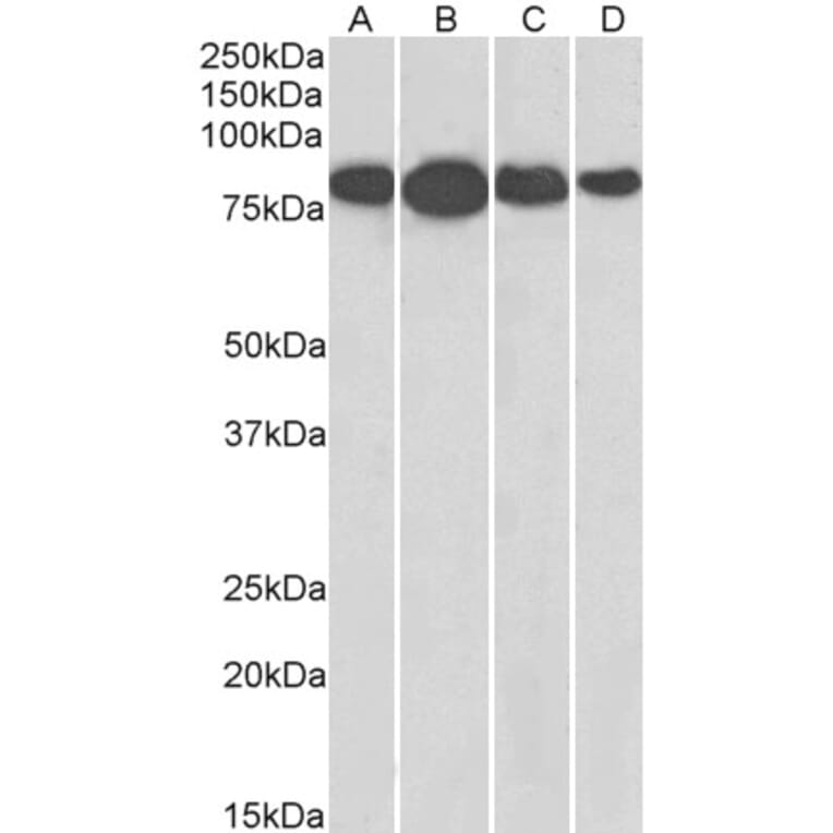 Western Blot - Anti-Radixin/RDX Antibody (A84229) - Antibodies.com