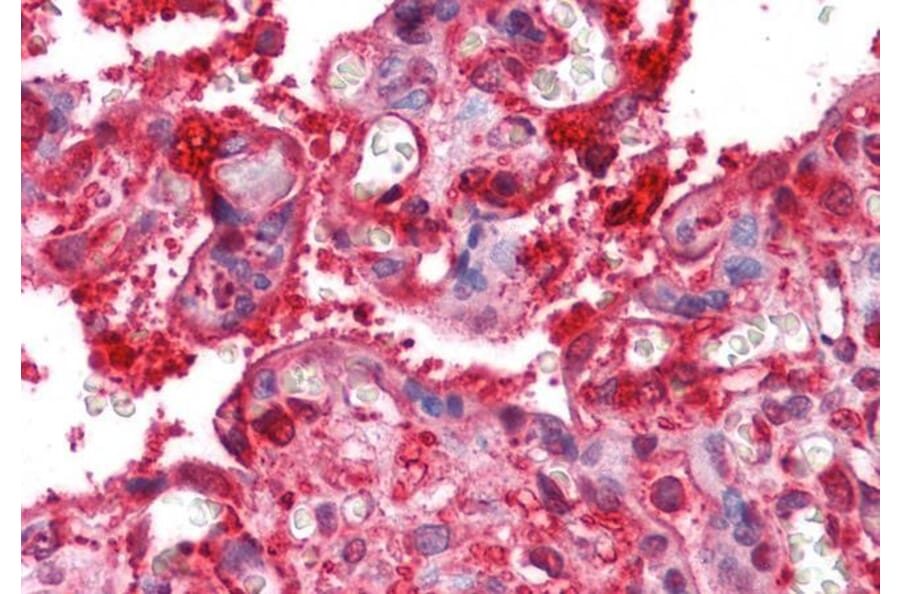 Immunohistochemistry - Anti-Radixin/RDX Antibody (A84229) - Antibodies.com