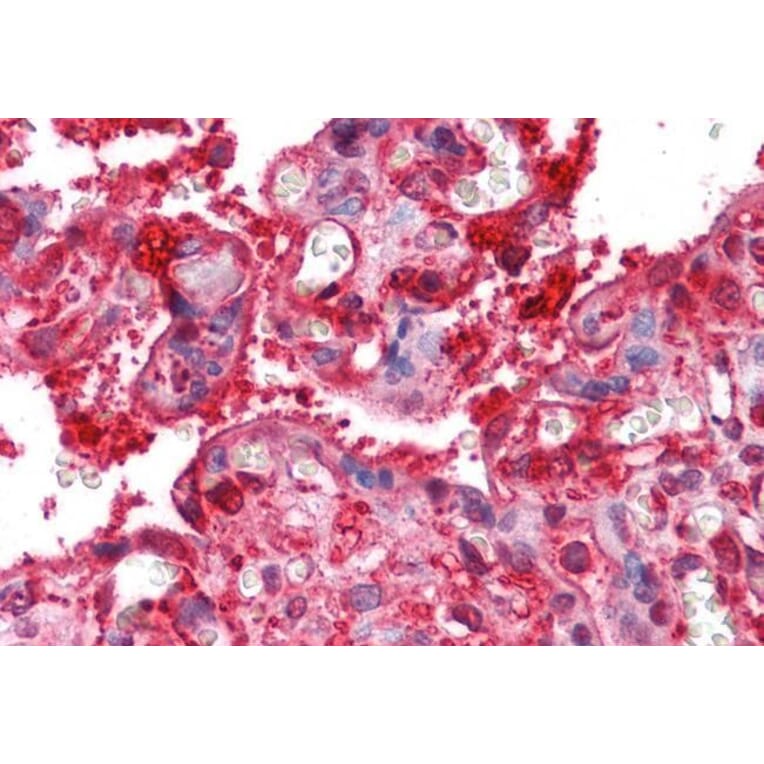 Immunohistochemistry - Anti-Radixin/RDX Antibody (A84229) - Antibodies.com