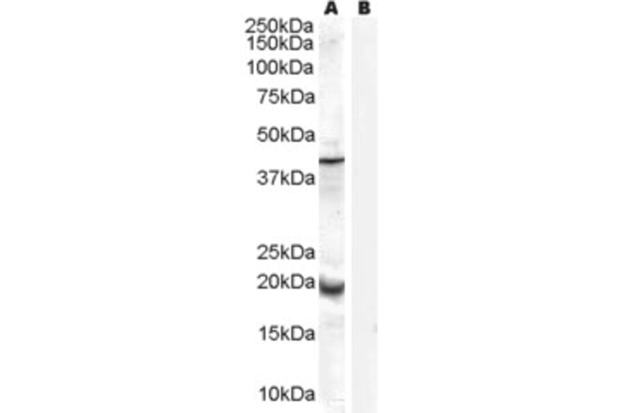Western Blot - Anti-GPx-7 Antibody (A84231) - Antibodies.com