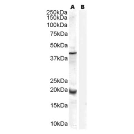 Western Blot - Anti-GPx-7 Antibody (A84231) - Antibodies.com
