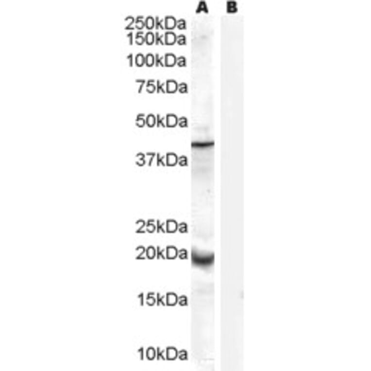 Western Blot - Anti-GPx-7 Antibody (A84231) - Antibodies.com