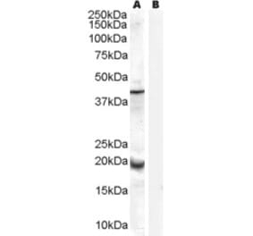 Western Blot - Anti-GPX7 Antibody (A84231) - Antibodies.com