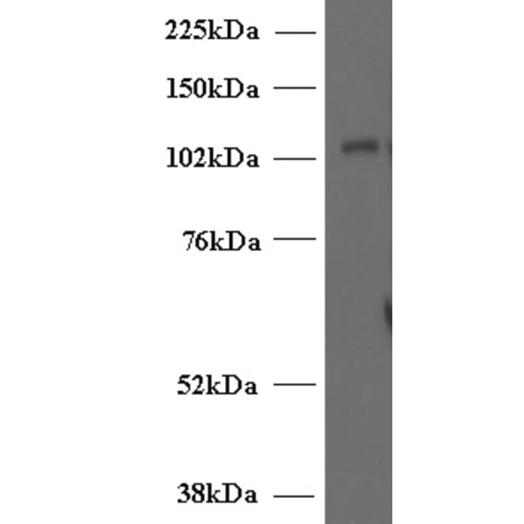 Western Blot - Anti-Munc 13-4 Antibody (A84232) - Antibodies.com