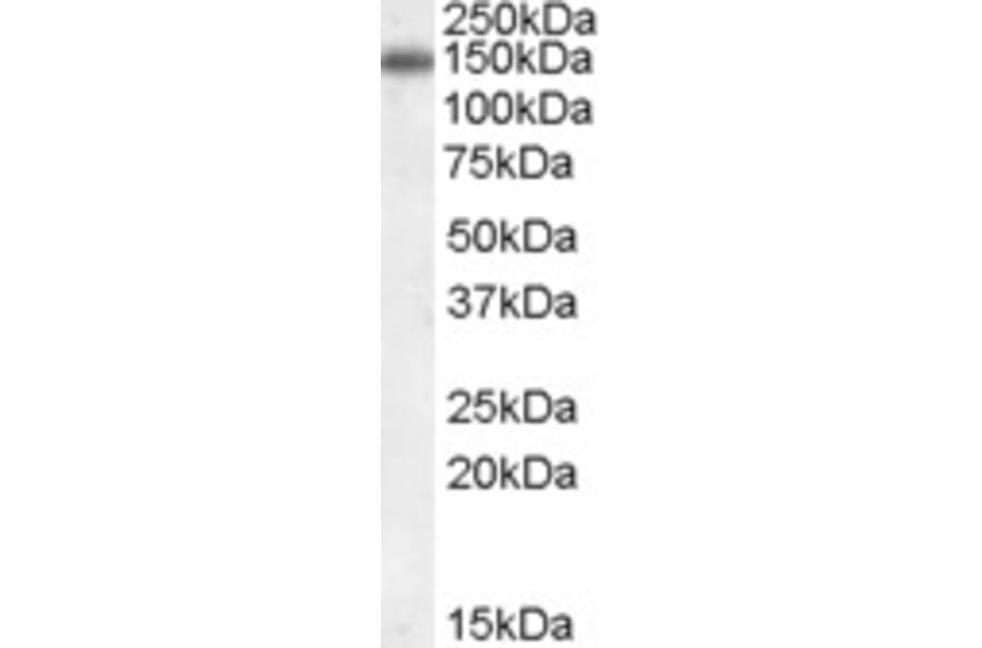 Western Blot - Anti-CILP Antibody (A84235) - Antibodies.com