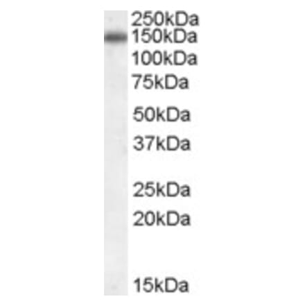 Western Blot - Anti-CILP Antibody (A84235) - Antibodies.com