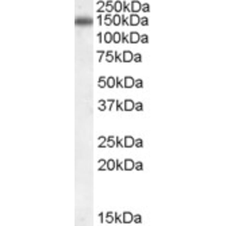 Western Blot - Anti-CILP Antibody (A84235) - Antibodies.com