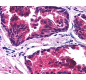 Immunohistochemistry - Anti-SNX26 Antibody (A84237) - Antibodies.com