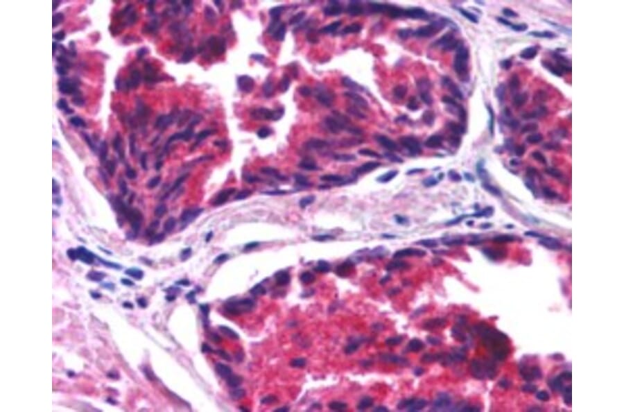 Immunohistochemistry - Anti-SNX26 Antibody (A84237) - Antibodies.com