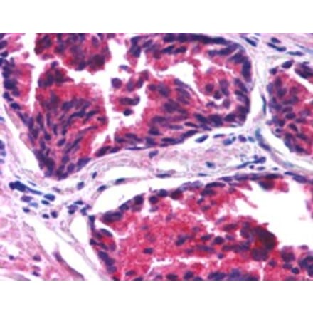 Immunohistochemistry - Anti-SNX26 Antibody (A84237) - Antibodies.com